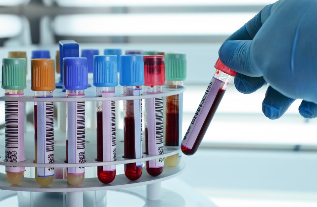 Genomic Prevention can improve NHS services